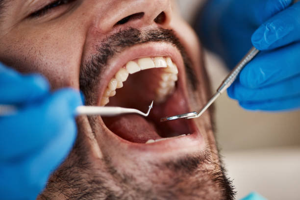 Best Emergency Dental Care for Broken or Chipped Teeth in Salem, MO