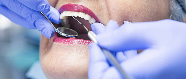 Best Emergency Denture Repair in Salem, MO